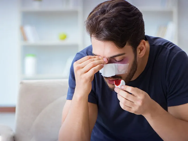 جلوگیری از خونریزی بعد از عمل بینی