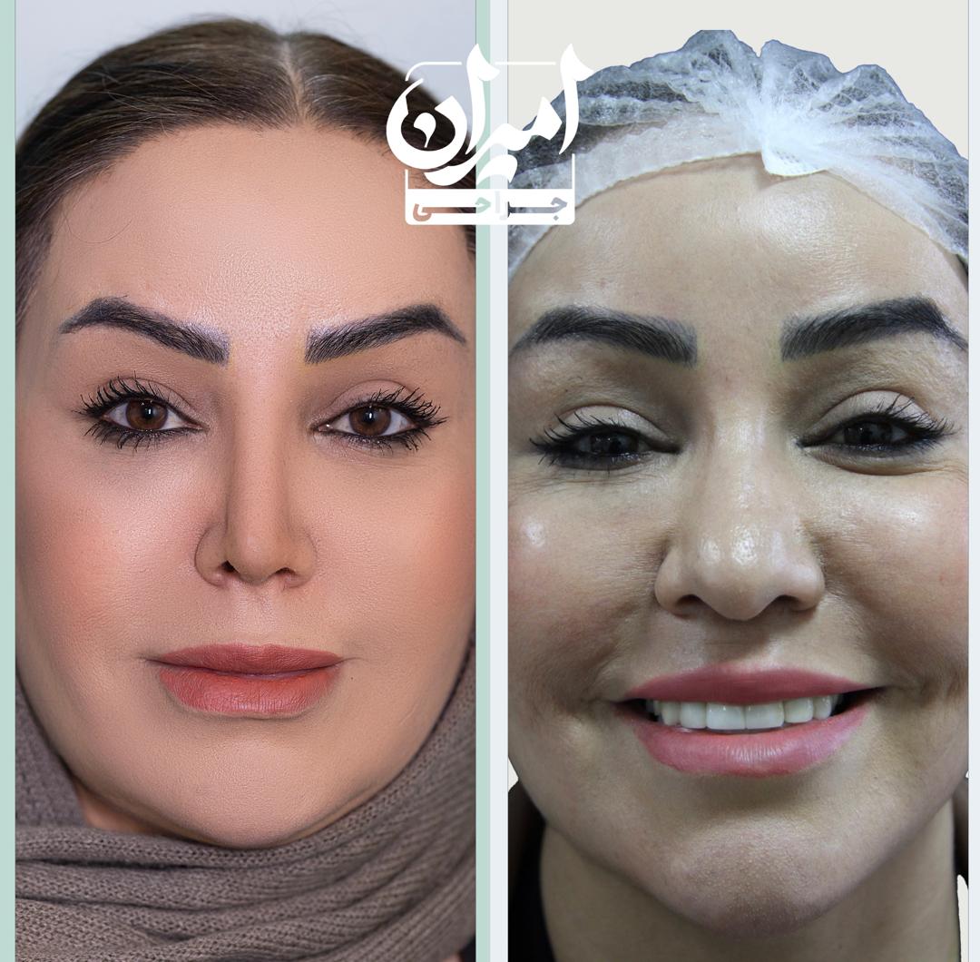 معرفی سه مدل عمل بینی
