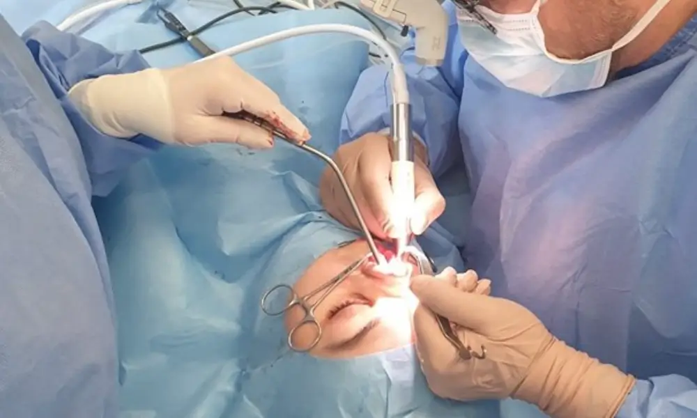 تفاوت عمل بینی با دستگاه پیزوسرجری و روش سنتی